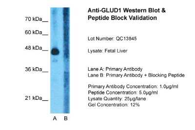 Western Blot: Glutamate Dehydrogenase Antibody [NBP1-54962]