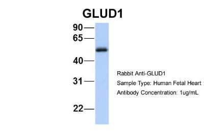 Western Blot: Glutamate Dehydrogenase Antibody [NBP1-54962]