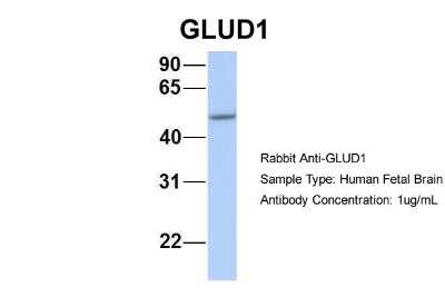 Western Blot: Glutamate Dehydrogenase Antibody [NBP1-54962]