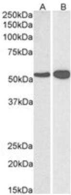 Western Blot: Glutamate Dehydrogenase Antibody [NBP1-68846]