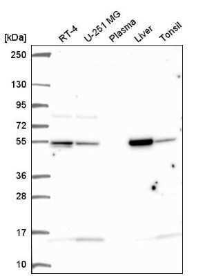 Western Blot: Glutamate Dehydrogenase Antibody [NBP2-57114]