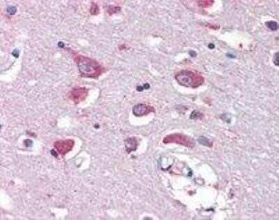 Immunohistochemistry-Paraffin: Glutamate Receptor 4 Antibody [NBP1-02312]
