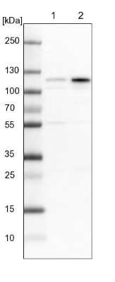 Western Blot: Glutamate Receptor 6 Antibody [NBP1-91946]