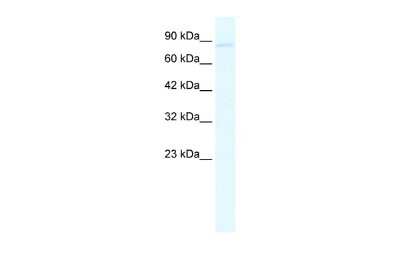 Western Blot: Glutamate Receptor 6 Antibody [NBP2-87508]