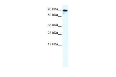 Western Blot: Glutamate Receptor 6 Antibody [NBP2-87509]
