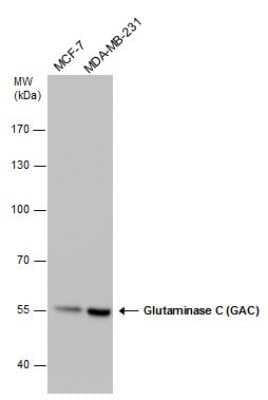 Western Blot: Glutaminase Antibody (3211) [NBP2-43762]