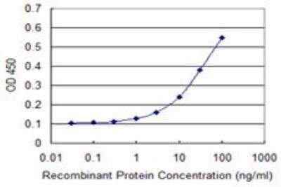 ELISA: Glutaminase Antibody (5C4) [H00002744-M01]