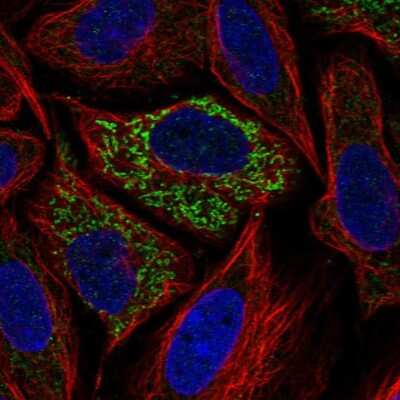 Immunocytochemistry/ Immunofluorescence: Glutaminase Antibody [NBP1-89766]