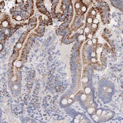 Immunohistochemistry-Paraffin: Glutaminase Antibody [NBP1-89766]