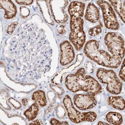 Immunohistochemistry-Paraffin: Glutaminase Antibody [NBP1-89766]