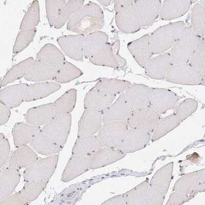 Immunohistochemistry-Paraffin: Glutaminase Antibody [NBP1-89766]