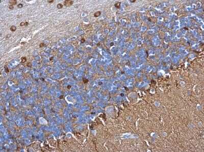 Immunohistochemistry-Paraffin: Glutamine Synthetase Antibody (1055) [NBP2-43646]