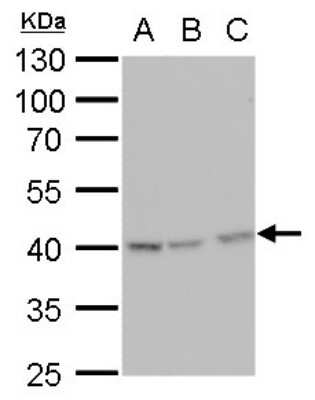 Western Blot: Glutamine Synthetase Antibody (1055) [NBP2-43646]