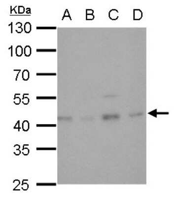 Western Blot: Glutamine Synthetase Antibody (1055) [NBP2-43646]
