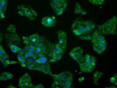 Immunocytochemistry/ Immunofluorescence: Glutamine Synthetase Antibody (OTI1F4) [NBP2-02125]