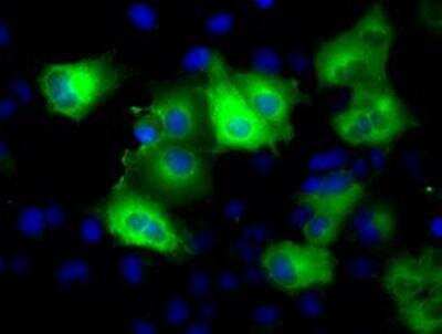Immunocytochemistry/ Immunofluorescence: Glutamine Synthetase Antibody (OTI1F4) [NBP2-02125]