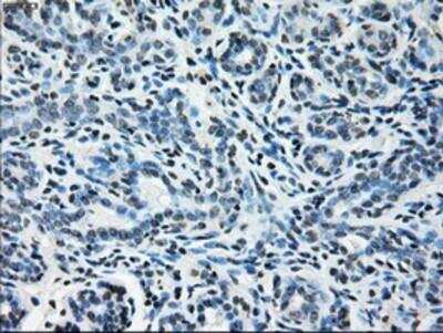 Immunohistochemistry-Paraffin: Glutamine Synthetase Antibody (OTI1F4) [NBP2-02125]
