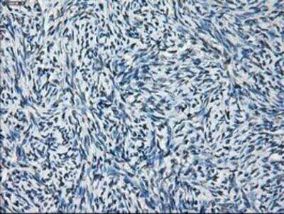 Immunohistochemistry-Paraffin: Glutamine Synthetase Antibody (OTI1F4) [NBP2-02125]