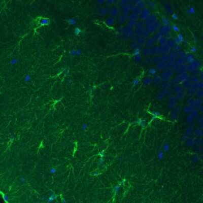 Immunohistochemistry: Glutamine Synthetase Antibody (CL3004) [NBP2-46644]