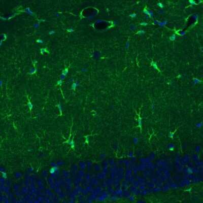 Immunohistochemistry: Glutamine Synthetase Antibody (CL3004) [NBP2-46644]