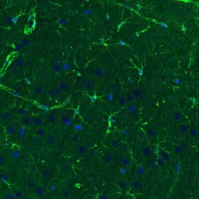 Immunohistochemistry: Glutamine Synthetase Antibody (CL3004) [NBP2-46644]