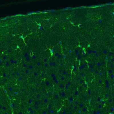 Immunohistochemistry: Glutamine Synthetase Antibody (CL3013) [NBP2-46645]