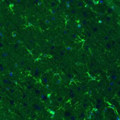 Immunohistochemistry: Glutamine Synthetase Antibody (CL3013) [NBP2-46645]