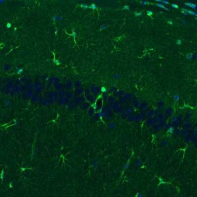 Immunohistochemistry: Glutamine Synthetase Antibody (CL3013) [NBP2-46645]