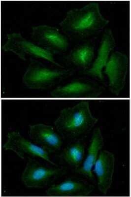Immunocytochemistry/ Immunofluorescence: Glutamine Synthetase Antibody (8D7) - BSA Free [NBP2-60240]