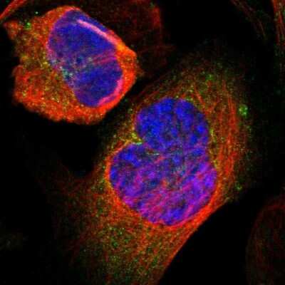 Immunocytochemistry/ Immunofluorescence: Glutamine Synthetase Antibody [NBP1-89767]