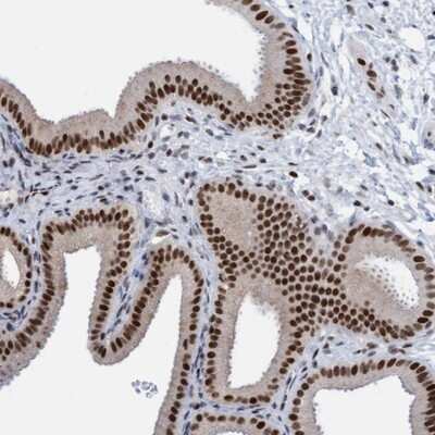 Immunohistochemistry-Paraffin: Glutaredoxin 2 Antibody [NBP1-90040]