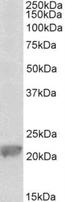 Western Blot: Glutathione Peroxidase 1/GPX1 Antibody [NBP2-26156]