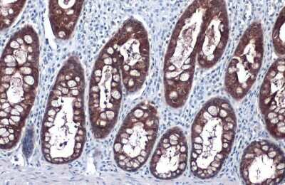 Immunohistochemistry-Paraffin: Glutathione Peroxidase 2/GPX2 Antibody (HL125) [NBP3-13662]