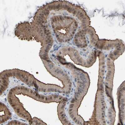 Immunohistochemistry-Paraffin: Glutathione Peroxidase 2/GPX2 Antibody [NBP2-47447]