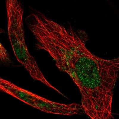 Immunocytochemistry/ Immunofluorescence: Glutathione Peroxidase 4/GPX4 Antibody [NBP2-56139]