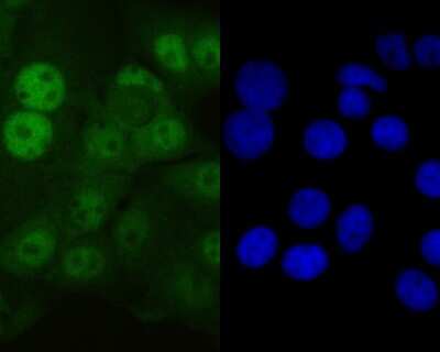 Immunocytochemistry/ Immunofluorescence: Glutathione Peroxidase 4/GPX4 Antibody (JU11-31) [NBP2-75511]