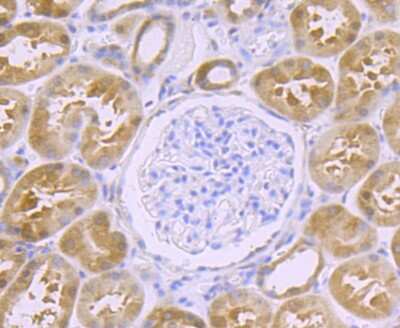 Immunohistochemistry-Paraffin: Glutathione Peroxidase 4/GPX4 Antibody (JU11-31) [NBP2-75511]