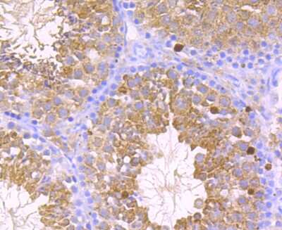 Immunohistochemistry-Paraffin: Glutathione Peroxidase 4/GPX4 Antibody (JU11-31) [NBP2-75511]