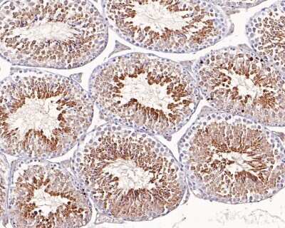Immunohistochemistry-Paraffin: Glutathione Peroxidase 4/GPX4 Antibody (JU11-31) [NBP2-75511]