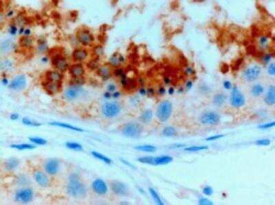 Immunohistochemistry-Paraffin: Glutathione Peroxidase 4/GPX4 Antibody - Isoform a and c [NB100-41379]