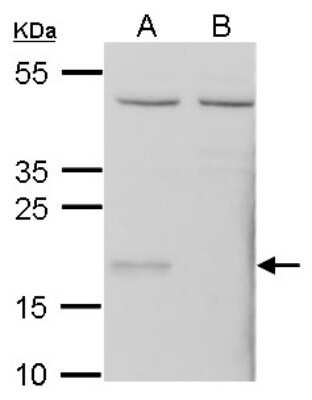 Western Blot: Glutathione Peroxidase 7 Antibody [NBP1-31924]