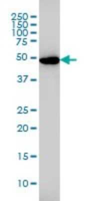 Western Blot: Glutathione Reductase Antibody (6B4) [H00002936-M01]
