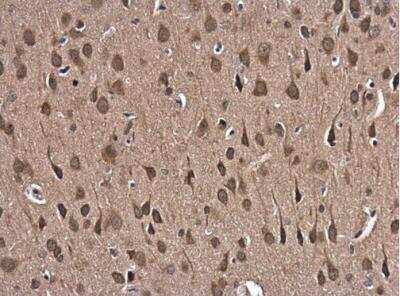 Immunohistochemistry-Paraffin: Glutathione Reductase Antibody [NBP2-16684]
