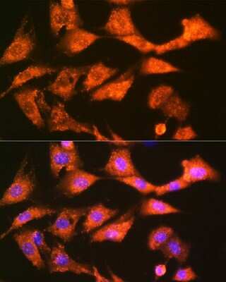 Immunocytochemistry/ Immunofluorescence: Glutathione S Transferase kappa 1 Antibody (7J5B3) [NBP3-16857]