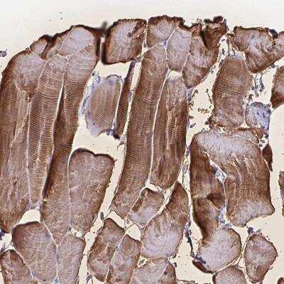 Immunohistochemistry-Paraffin: Glutathione S-Transferase mu 1/GSTM1 Antibody [NBP2-46827]