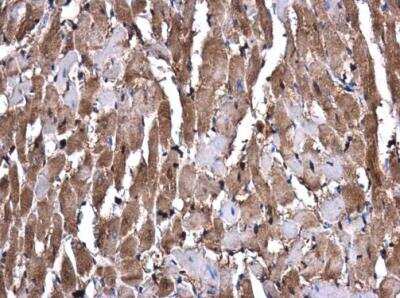 Immunohistochemistry-Paraffin: Glutathione S-Transferase mu 1/GSTM1 Antibody [NBP1-33523]