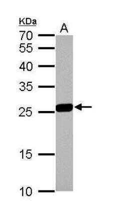 Western Blot: Glutathione S-Transferase mu 1/GSTM1 Antibody [NBP1-33523]