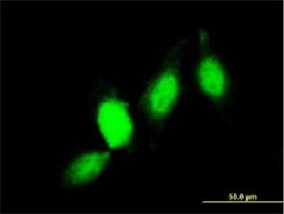 Immunocytochemistry/ Immunofluorescence: Glutathione S-Transferase pi 1/GSTP1 Antibody (2G6-F6) [H00002950-M01]