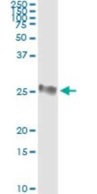 Immunoprecipitation: Glutathione S-Transferase pi 1/GSTP1 Antibody (2G6-F6) [H00002950-M01]
