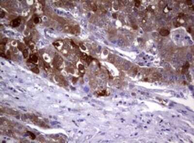 Immunohistochemistry: Glutathione S-Transferase pi 1/GSTP1 Antibody (OTI4B6) [NBP2-45916]
